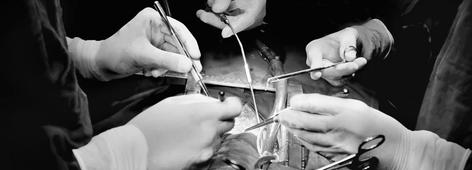 Surgical team hands during operation